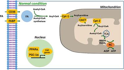 Defective Mitochondrial Fatty Acid Oxidation and Lipotoxicity in Kidney Diseases